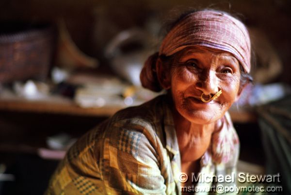 Woman with Goiter, Chainpur
